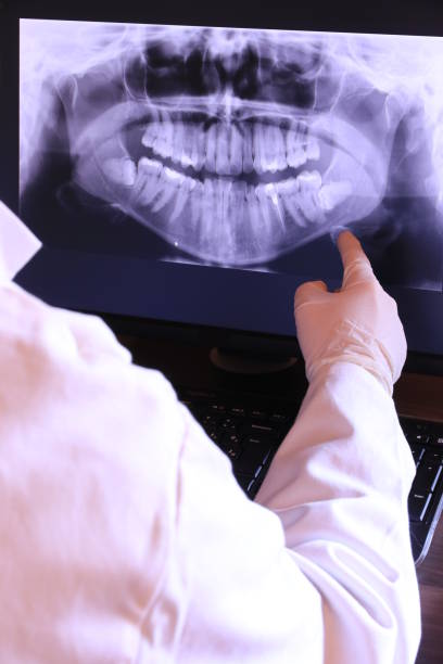 Best Emergency Broken Tooth Repair in Lton, IN