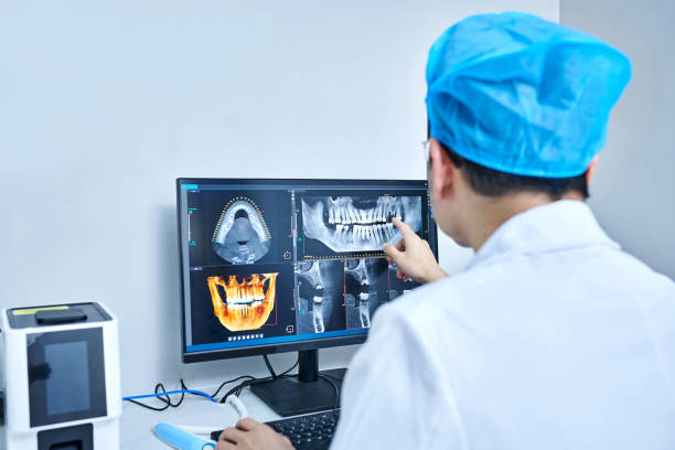 Best Emergency Root Canal Treatment in Lton, IN